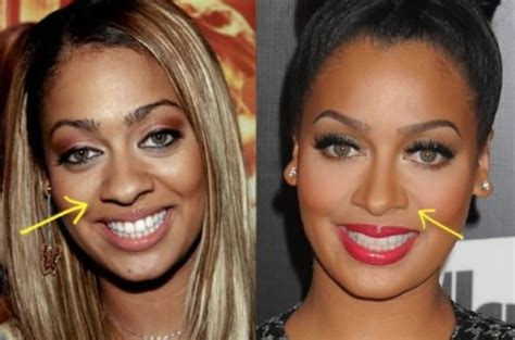 did lala anthony have plastic surgery|LaLa Anthony to Executive Produce “Killer Curves: Bodies To Die .